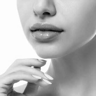 lip-lift-botox copy 2